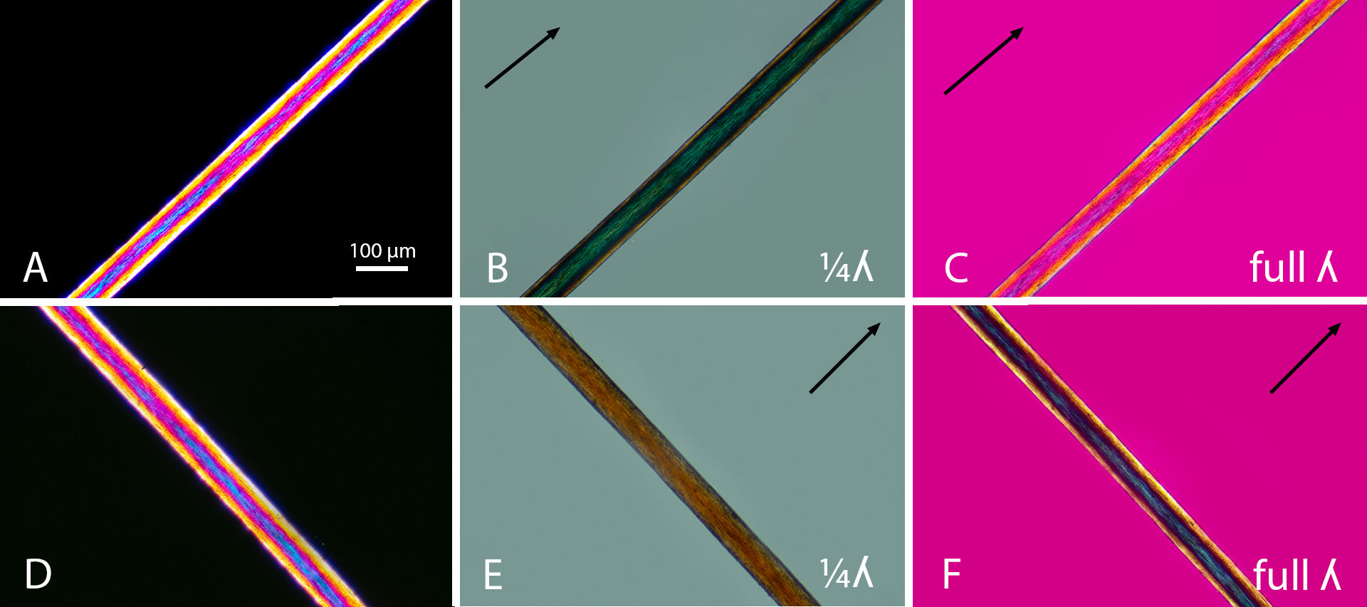 The Importance of the Correct Coverglass thickness for Photomicrograph