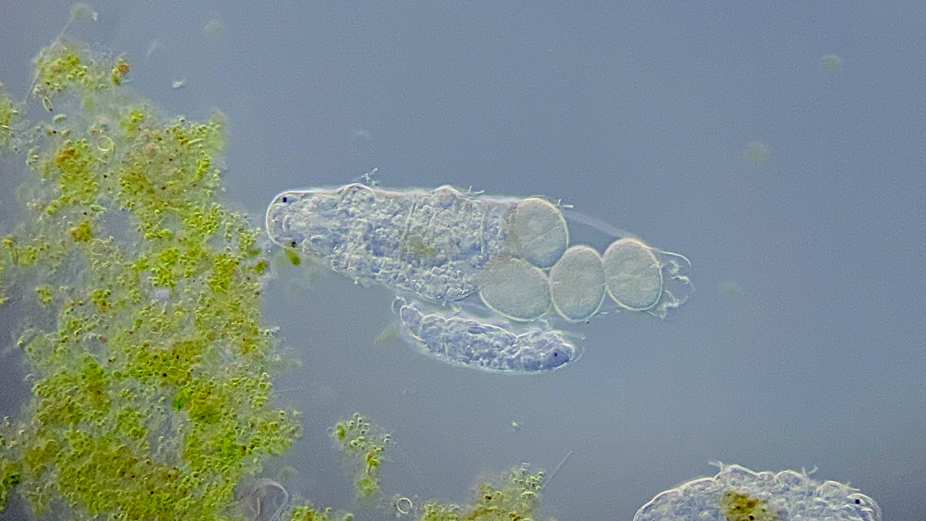 microscopic animals in pond water