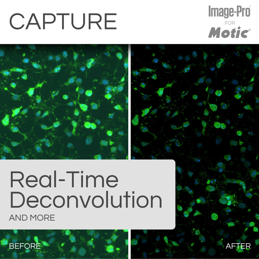 PA53-FL & Image-Pro® Analysis Package – Motic Microscopes