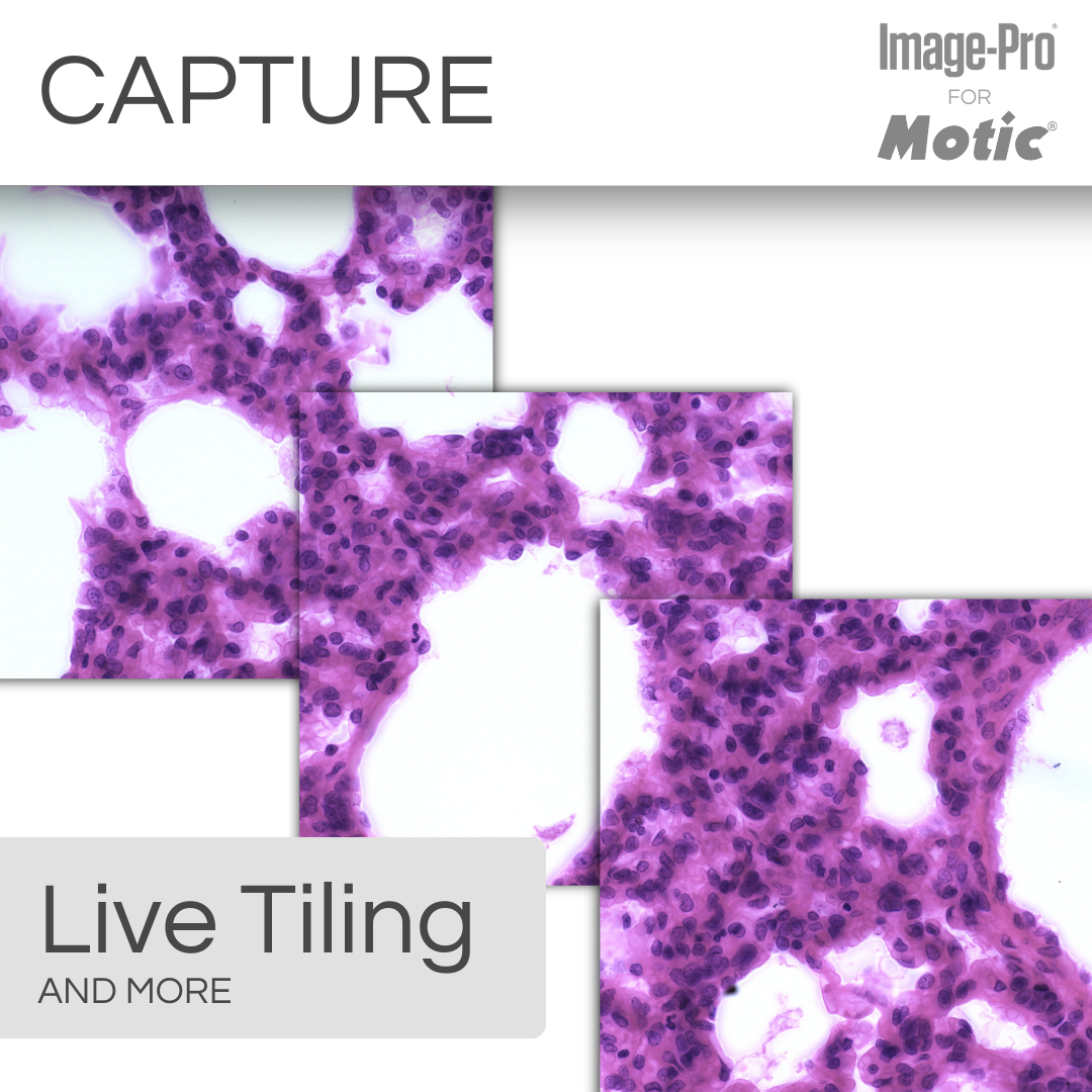 PA53-Clinical & Image Pro® Analysis Package – Motic Microscopes