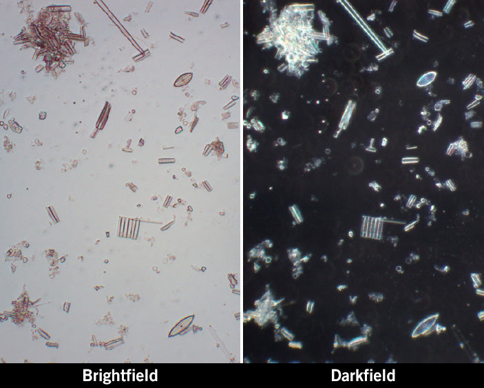 Basic Microscopy Concepts - Introduction to Darkfield Illumination: Slider Solution