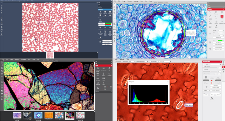 Enhance your digital microscopy platform with Motic's professional image analysis tools