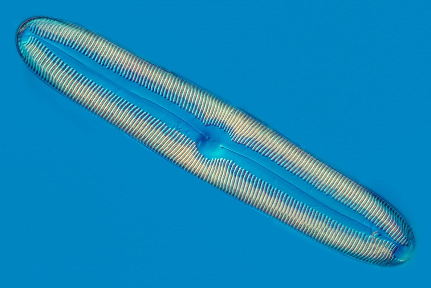 Diatom Pinnularia DIC microscopy