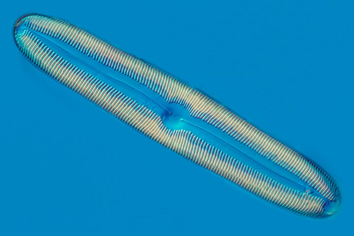 Diatom Pinnularia DIC microscopy