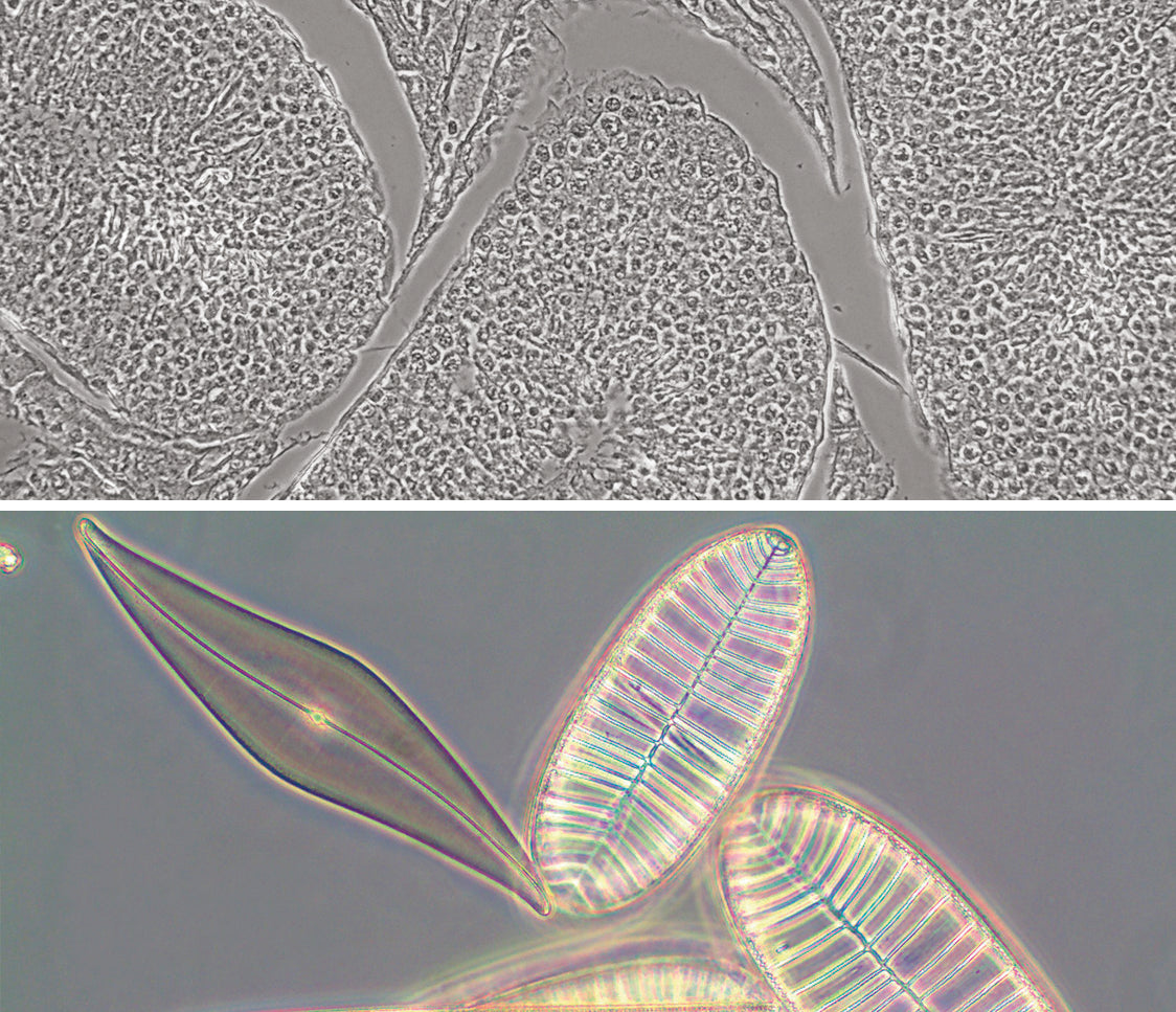 Basic Microscopy Concepts - Phase Contrast Adjustment