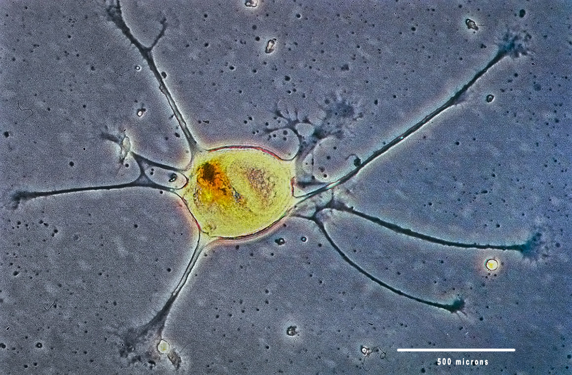 Beyond Magnification: Understanding Microscope Objectives (Part II)