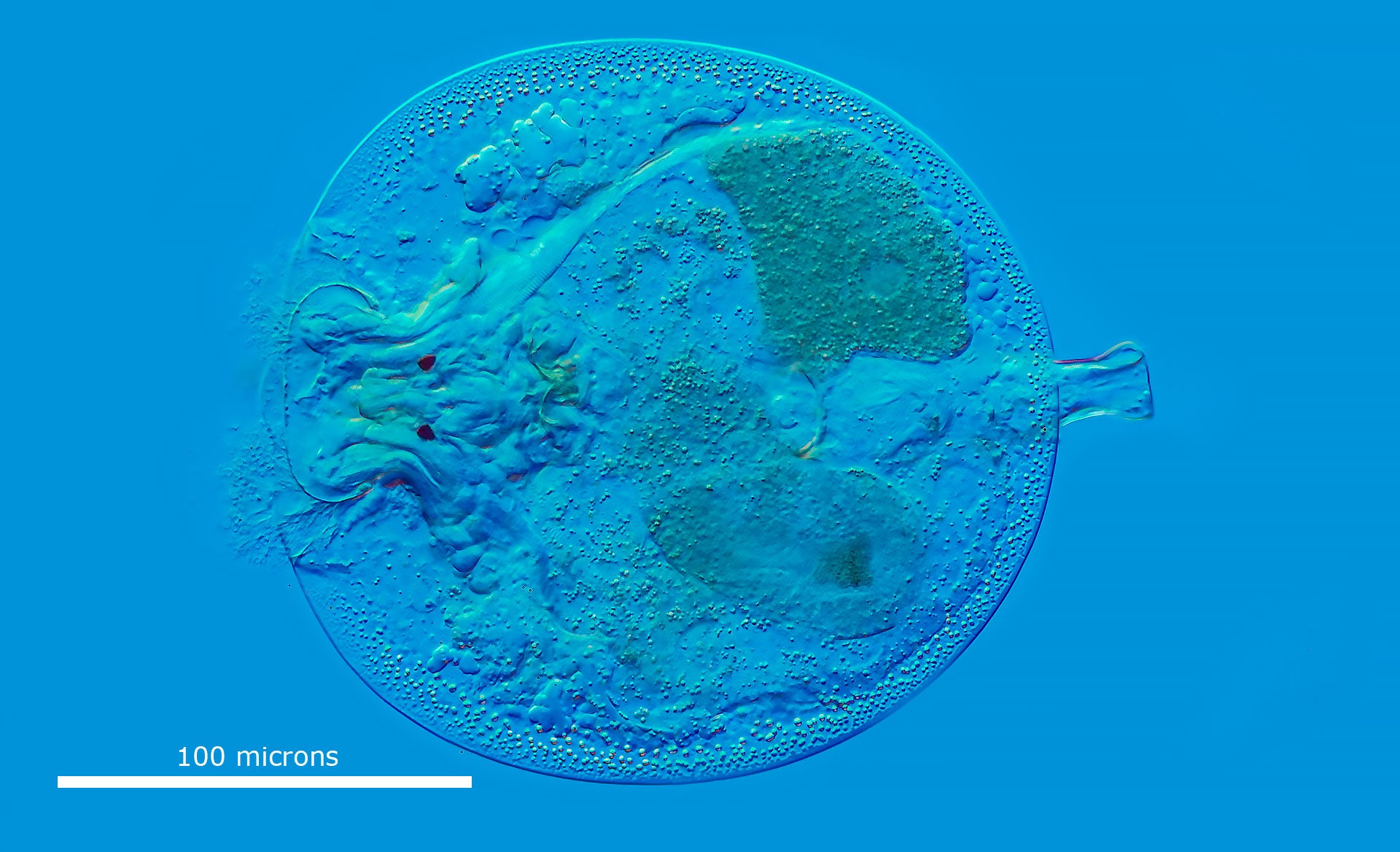 Microscopic viewing of Aquatic Invertebrates:  Ciliates, Rotifers, Cladocerans, Insects, Hydra, and Amoeba