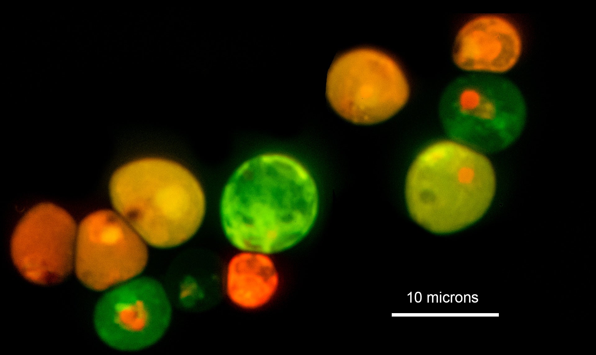 Yeast cells
